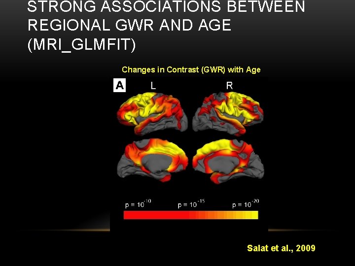 STRONG ASSOCIATIONS BETWEEN REGIONAL GWR AND AGE (MRI_GLMFIT) Changes in Contrast (GWR) with Age