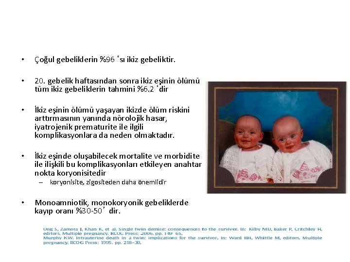 • Çoğul gebeliklerin %96‘sı ikiz gebeliktir. • 20. gebelik haftasından sonra ikiz eşinin