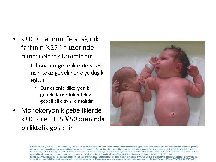  • sİUGR tahmini fetal ağırlık farkının %25‘in üzerinde olması olarak tanımlanır. – Dikoryonik