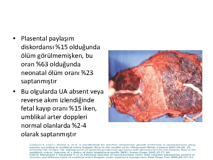  • Plasental paylaşım diskordansı %15 olduğunda ölüm görülmemişken, bu oran %63 olduğunda neonatal