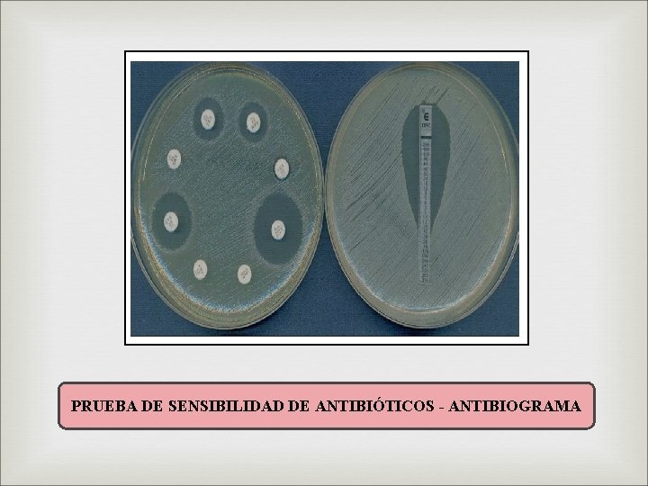 PRUEBA DE SENSIBILIDAD DE ANTIBIÓTICOS - ANTIBIOGRAMA 