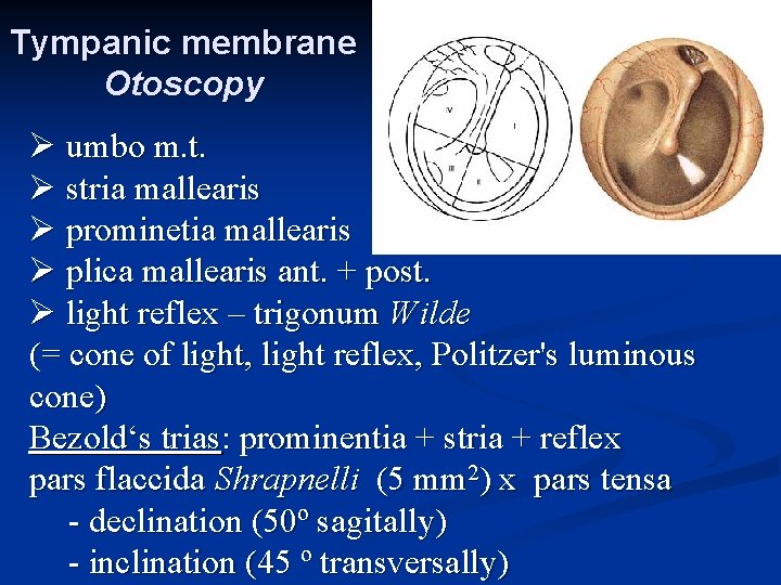 Tympanic membrane Otoscopy Ø umbo m. t. Ø stria mallearis Ø prominetia mallearis Ø Tympanic membrane Otoscopy Ø umbo m. t. Ø stria mallearis Ø prominetia mallearis Ø