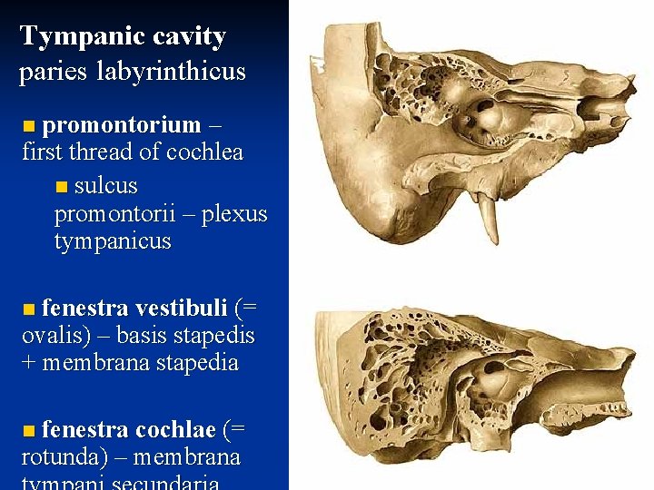 Tympanic cavity paries labyrinthicus promontorium – first thread of cochlea n sulcus promontorii –