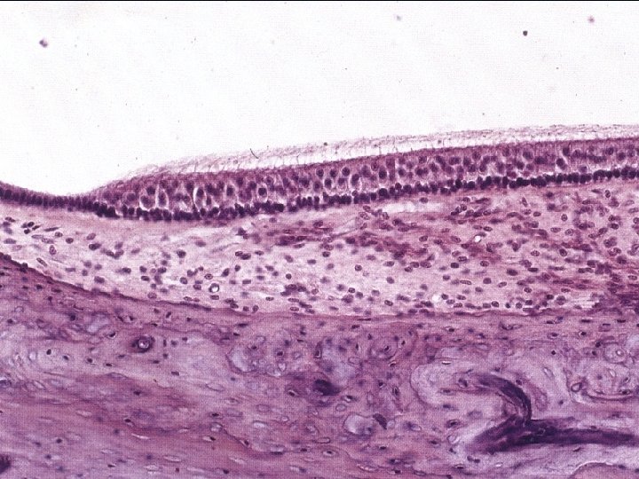 Hair cells n two types n apical surface: n n n 1 kinocilia more