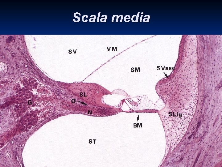 Scala media contains endolymph n lamina basilaris with Corti‘s organ n membrana tectoria covers