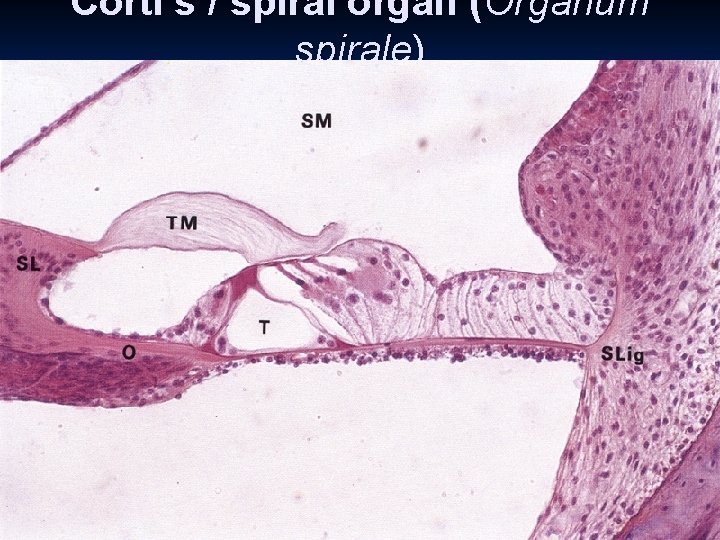 Corti‘s / spiral organ (Organum spirale) n hair cells external (3 -4 rows) and