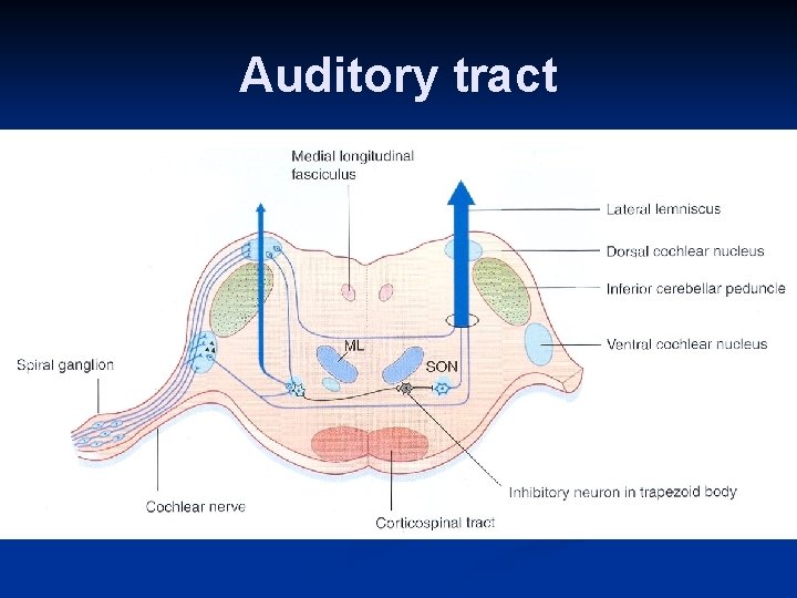 Auditory tract 