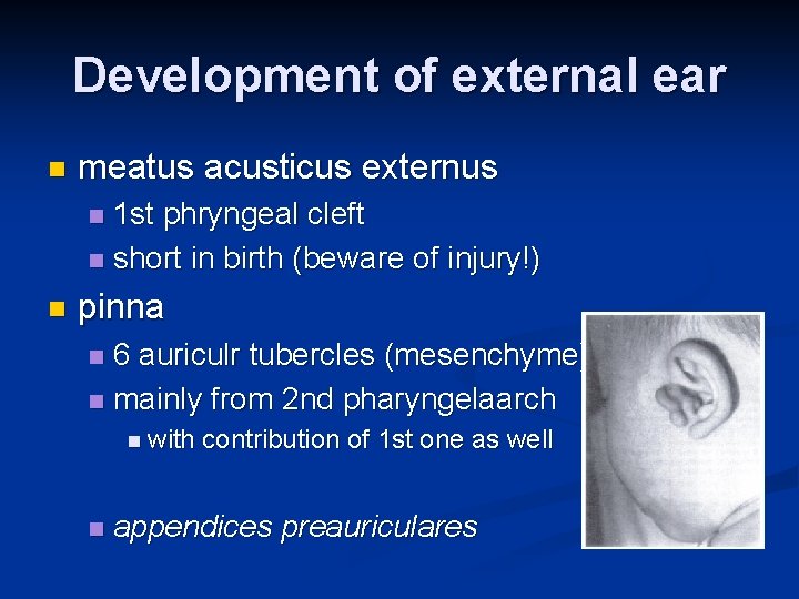 Development of external ear n meatus acusticus externus 1 st phryngeal cleft n short