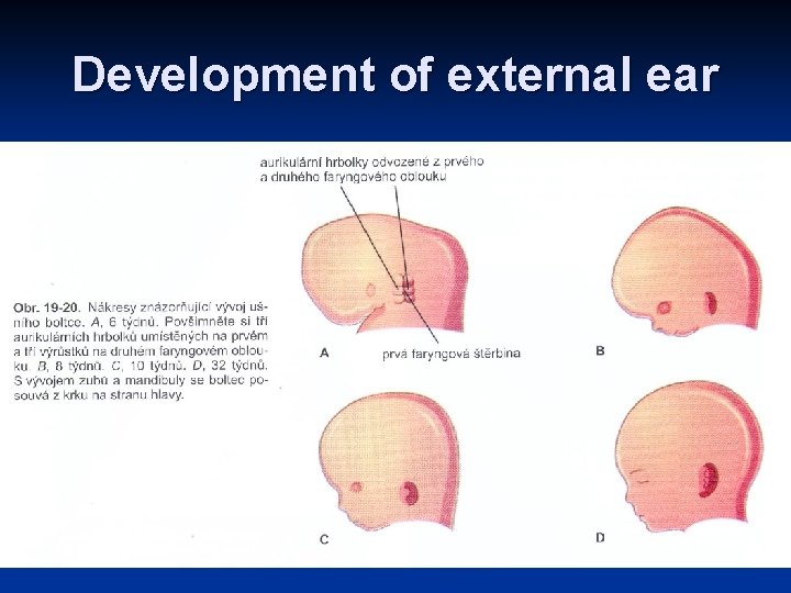 Development of external ear 