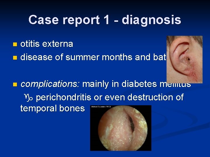 Case report 1 - diagnosis otitis externa n disease of summer months and bathing