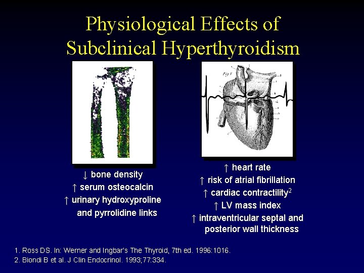 Physiological Effects of Subclinical Hyperthyroidism ↓ bone density ↑ serum osteocalcin ↑ urinary hydroxyproline