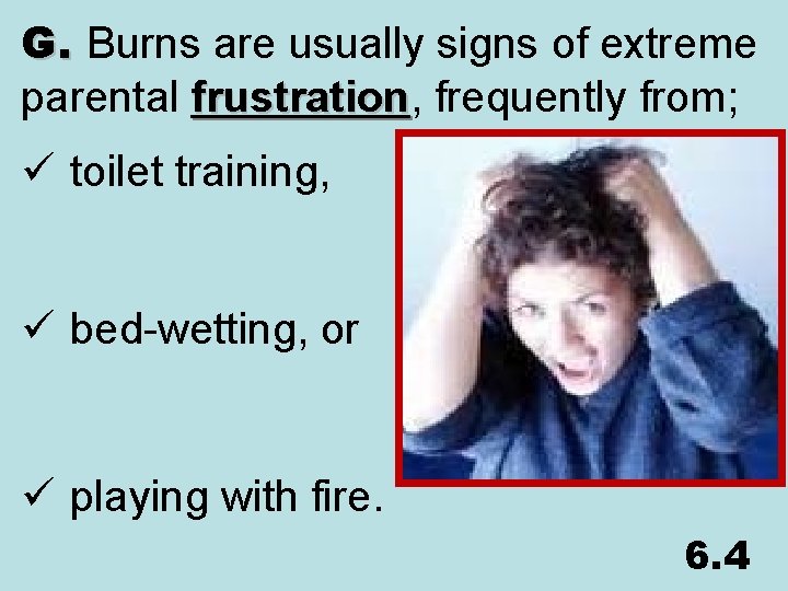 G. Burns are usually signs of extreme parental frustration, frustration frequently from; ü toilet