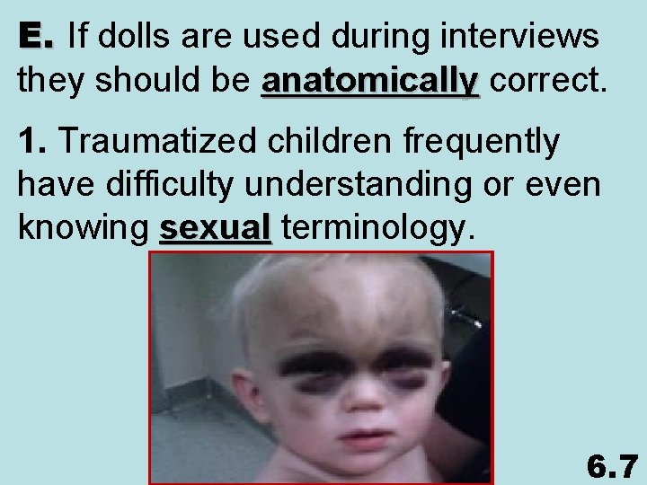 E. If dolls are used during interviews they should be anatomically correct. 1. Traumatized