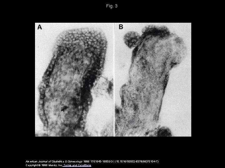 Fig. 3 American Journal of Obstetrics & Gynecology 1996 1751543 -1550 DOI: (10. 1016/S