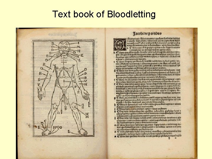 Text book of Bloodletting 