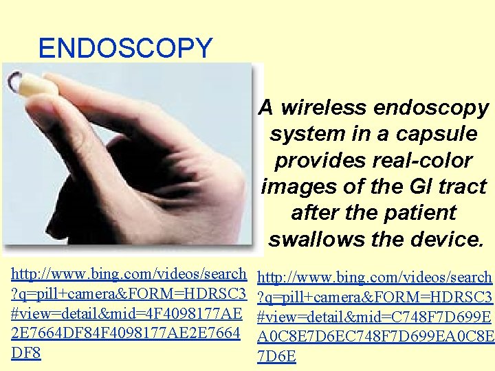 ENDOSCOPY A wireless endoscopy system in a capsule provides real-color images of the GI