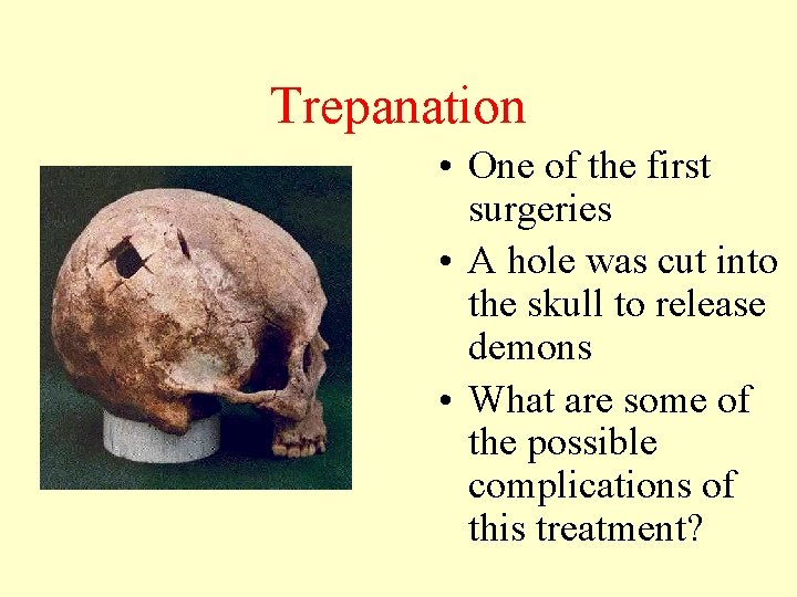 Trepanation • One of the first surgeries • A hole was cut into the