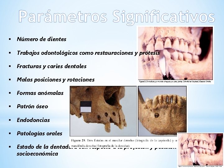 Parámetros Significativos § Número de dientes § Trabajos odontológicos como restauraciones y prótesis §