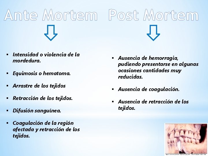 Ante Mortem Post Mortem § Intensidad o violencia de la mordedura. § Equimosis o