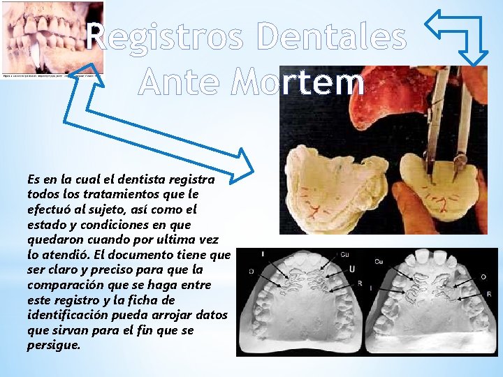Registros Dentales Ante Mortem Es en la cual el dentista registra todos los tratamientos