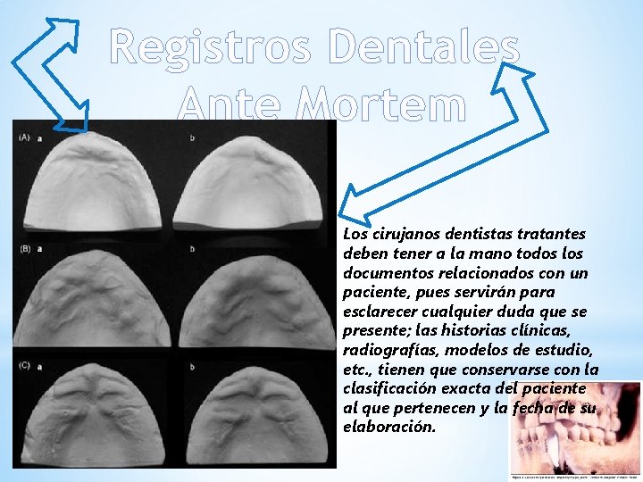 Registros Dentales Ante Mortem Los cirujanos dentistas tratantes deben tener a la mano todos