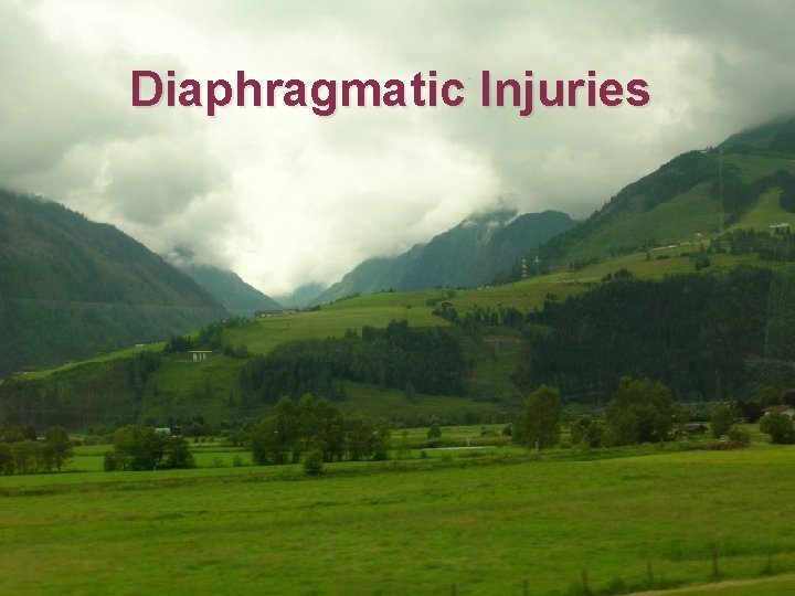Diaphragmatic Injuries 
