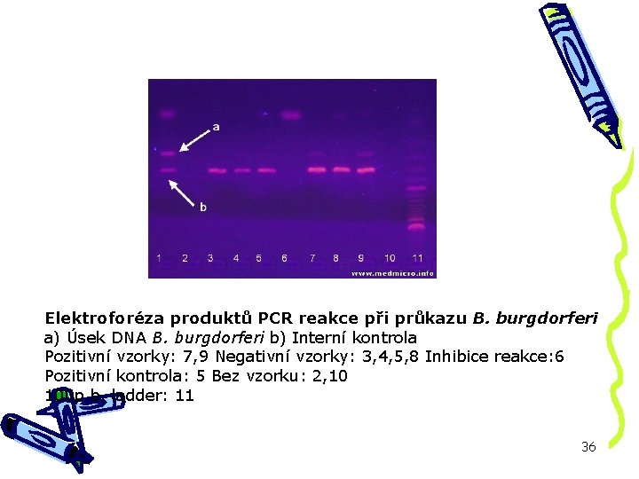 Elektroforéza produktů PCR reakce při průkazu B. burgdorferi a) Úsek DNA B. burgdorferi b)