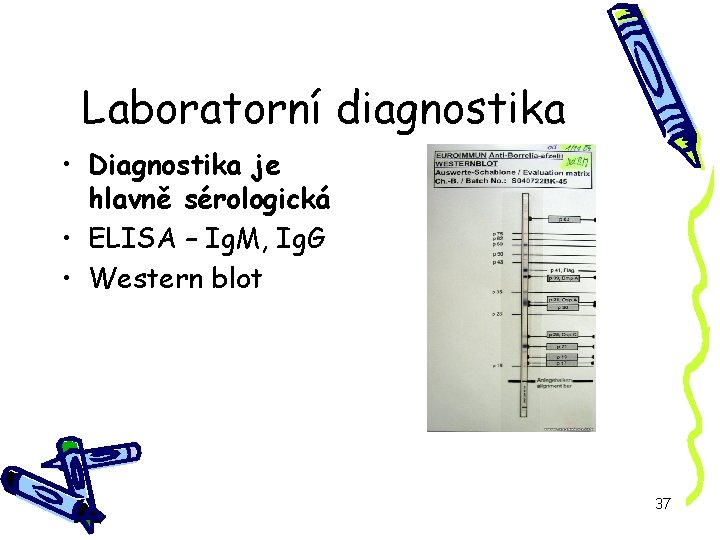 Laboratorní diagnostika • Diagnostika je hlavně sérologická • ELISA – Ig. M, Ig. G