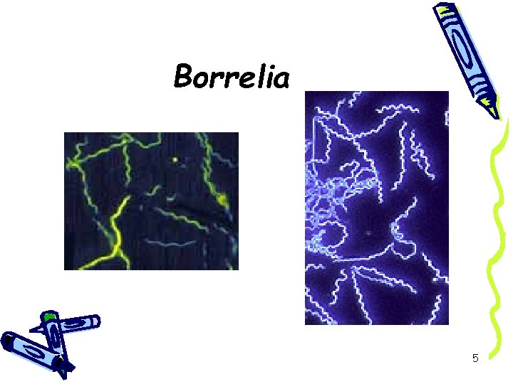 Borrelia 5 