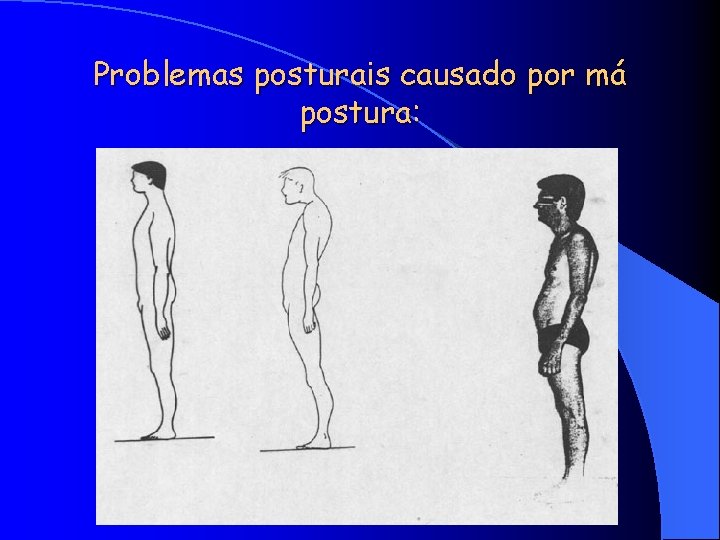 Problemas posturais causado por má postura: 