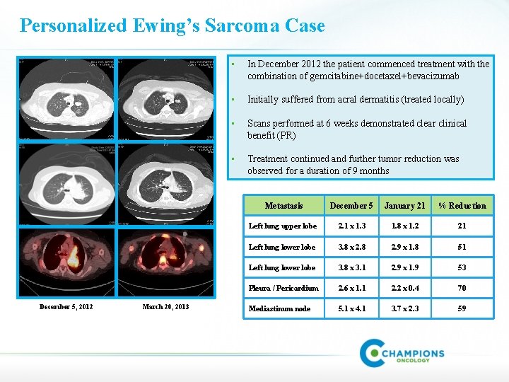 Personalized Ewing’s Sarcoma Case December 5, 2012 March 20, 2013 • In December 2012
