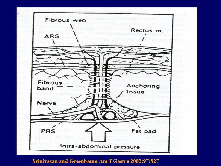 Srinivasan and Greenbaum Am J Gastro 2002; 97: 827 