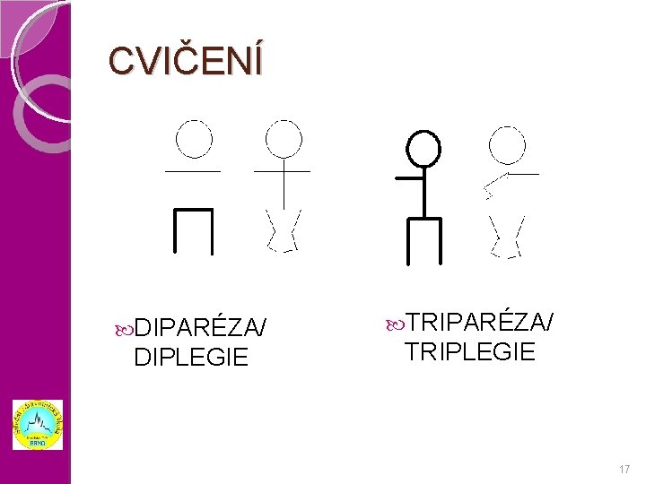 CVIČENÍ DIPARÉZA/ DIPLEGIE TRIPARÉZA/ TRIPLEGIE 17 