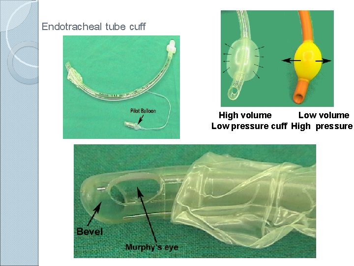 Endotracheal tube cuff High volume Low pressure cuff High pressure 