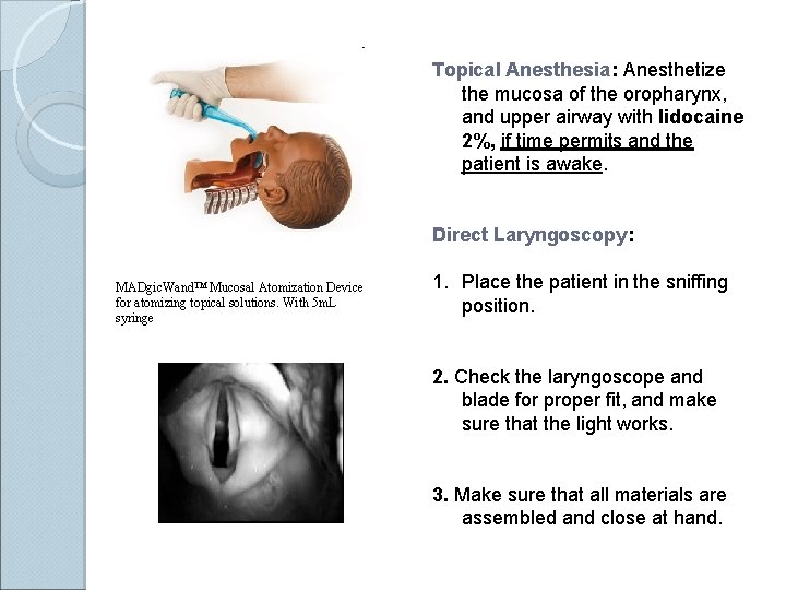 Topical Anesthesia: Anesthetize the mucosa of the oropharynx, and upper airway with lidocaine 2%,