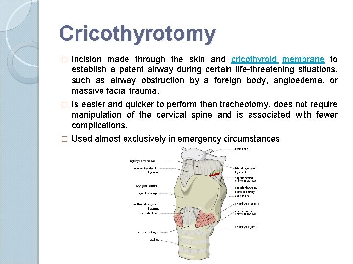 Cricothyrotomy � Incision made through the skin and cricothyroid membrane to establish a patent