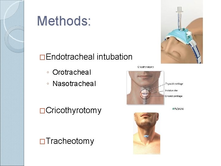 Methods: �Endotracheal intubation ◦ Orotracheal ◦ Nasotracheal �Cricothyrotomy �Tracheotomy 