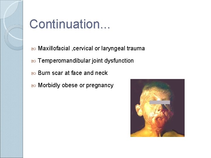 Continuation. . . Maxillofacial , cervical or laryngeal trauma Temperomandibular joint dysfunction Burn scar