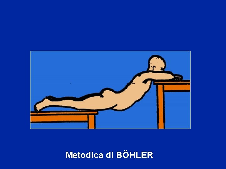 Metodica di BÖHLER 