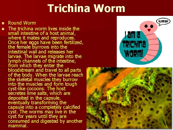 Trichina Worm n n Round Worm The trichina worm lives inside the small intestine