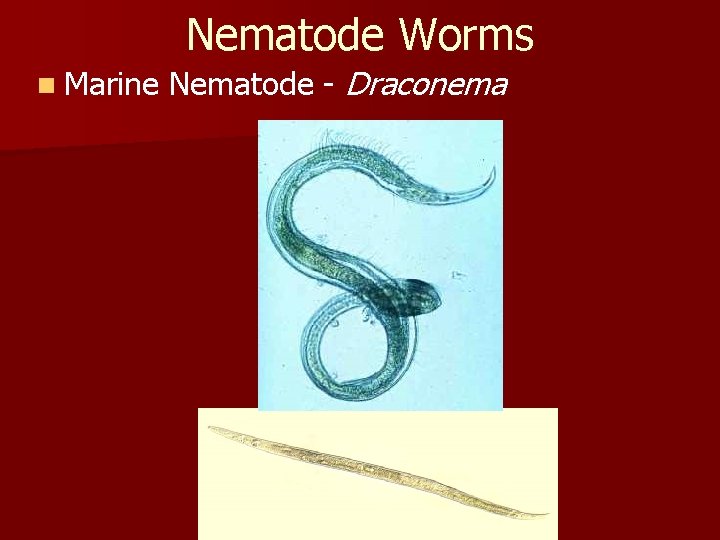 Nematode Worms n Marine Nematode - Draconema 