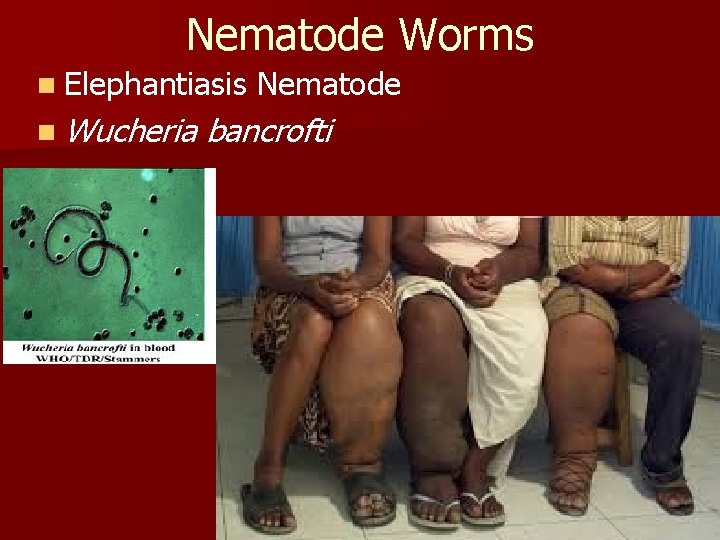 Nematode Worms n Elephantiasis Nematode n Wucheria bancrofti 