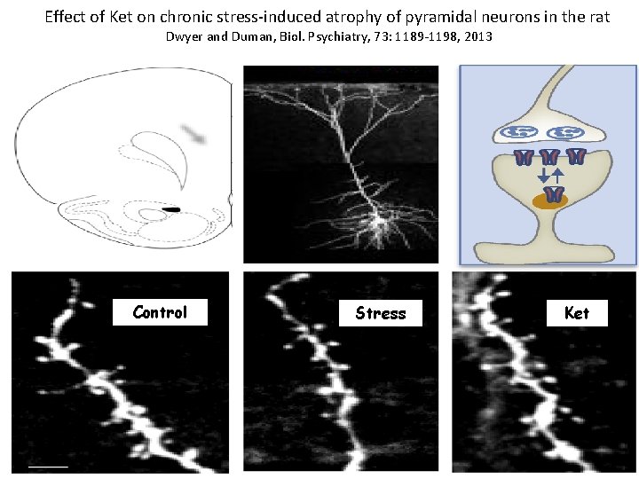 Effect of Ket on chronic stress-induced atrophy of pyramidal neurons in the rat Dwyer