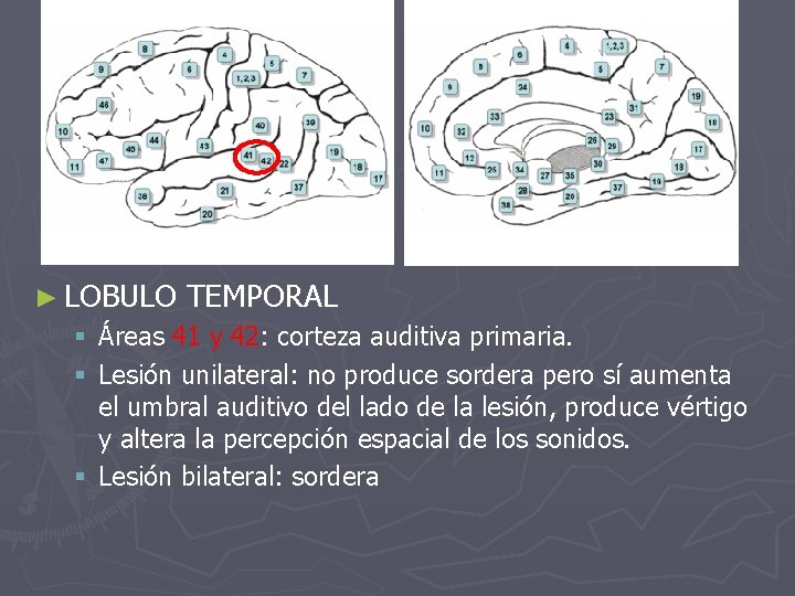 ► LOBULO TEMPORAL § Áreas 41 y 42: corteza auditiva primaria. § Lesión unilateral: