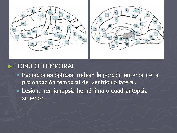 ► LOBULO TEMPORAL § Radiaciones ópticas: rodean la porción anterior de la prolongación temporal