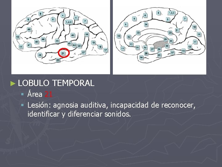 ► LOBULO TEMPORAL § Área 21 § Lesión: agnosia auditiva, incapacidad de reconocer, identificar