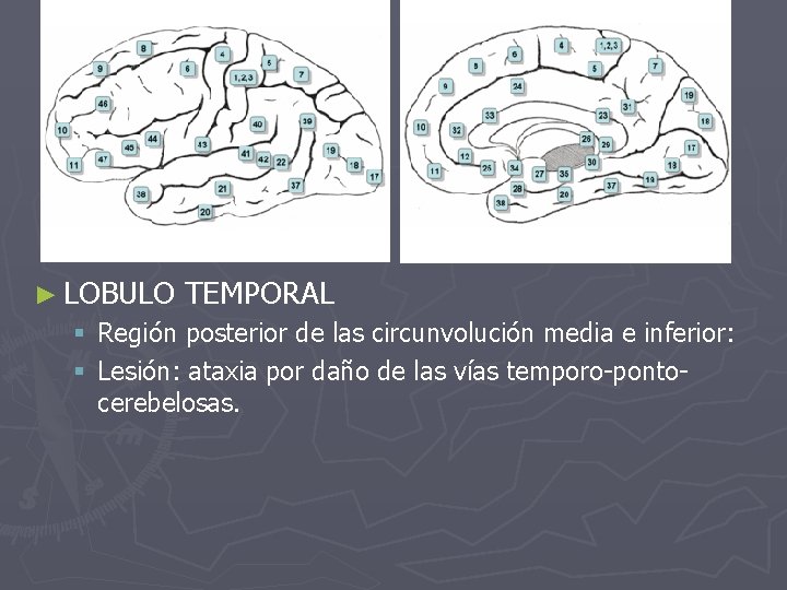 ► LOBULO TEMPORAL § Región posterior de las circunvolución media e inferior: § Lesión: