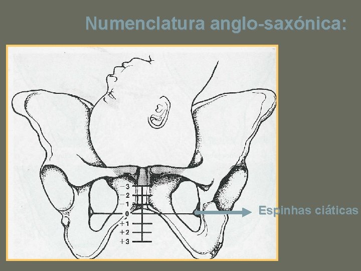 Numenclatura anglo-saxónica: Espinhas ciáticas 