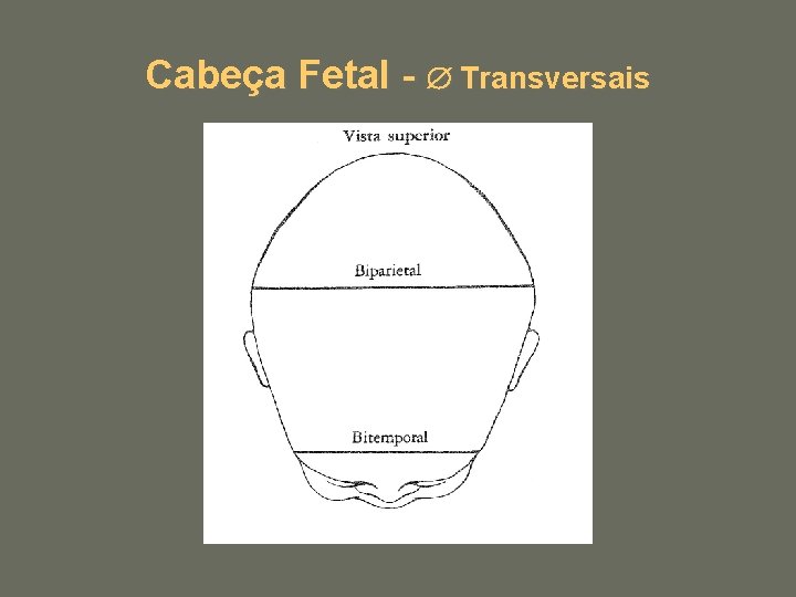 Cabeça Fetal - Transversais 