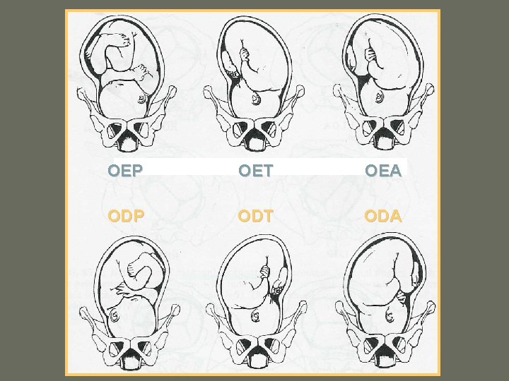 OEP OET OEA ODP ODT ODA 